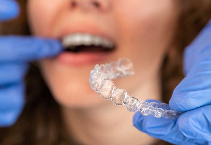 Early Orthodontic Treatment