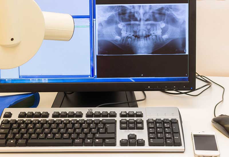 Orthognathic Surgery