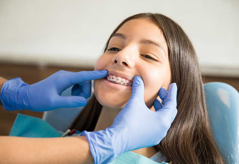 Adult Orthodontic Treatment